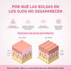 Lumavie™ Lentes de Rehabilitación de Ojeras